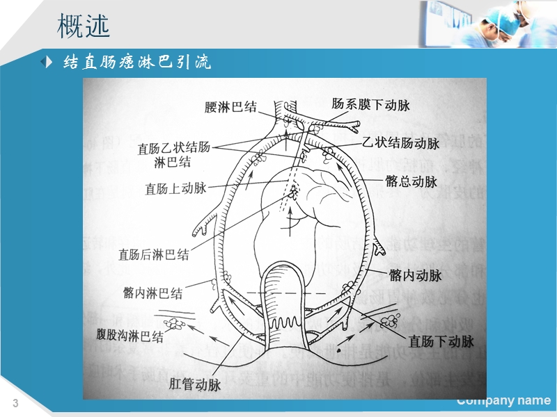 2013结直肠癌肝转移诊断和综合治疗指南解读.ppt_第3页