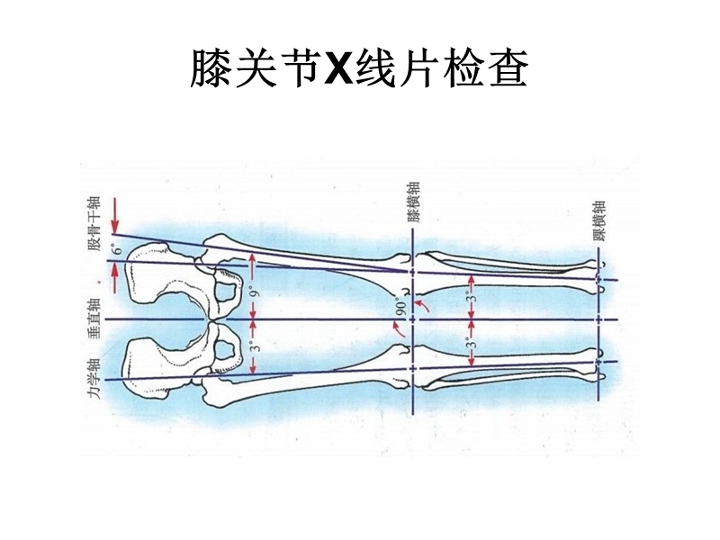 膝关节x线片检查.ppt_第3页