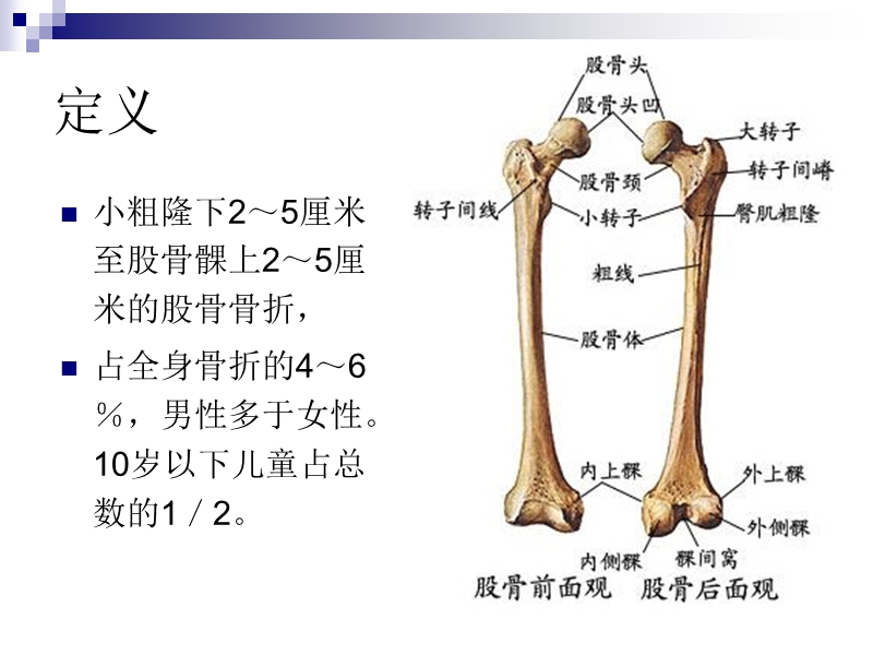 股骨干骨折诊断治疗.ppt_第2页