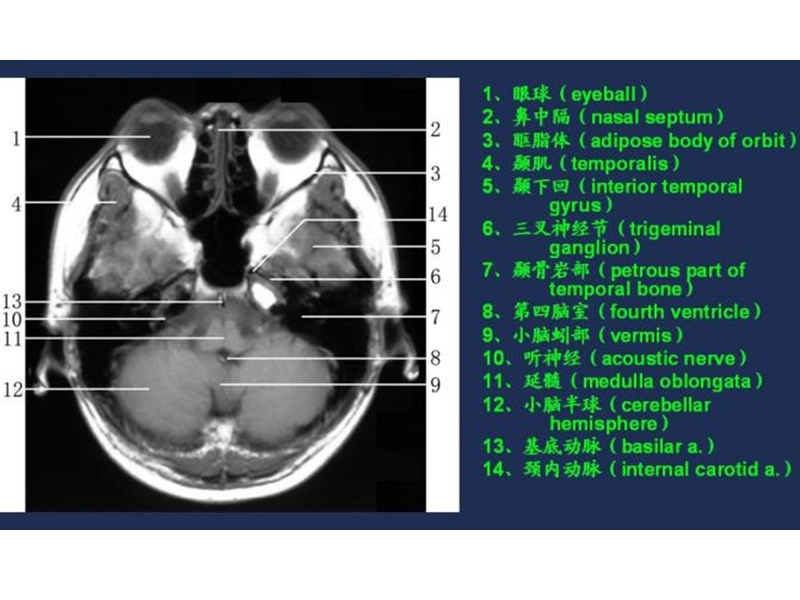 mri常用解剖.ppt_第2页