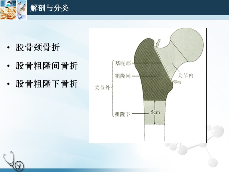 老年股骨近端骨折的手术治疗.ppt_第2页