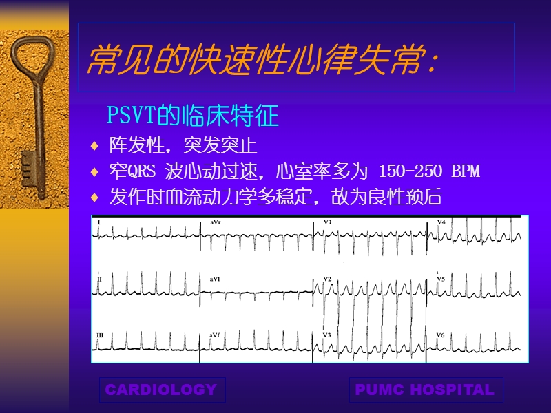 快速性心律失常.ppt_第3页