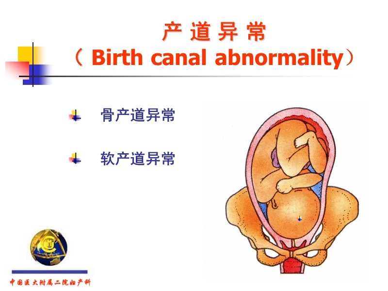 产道异常.ppt_第2页