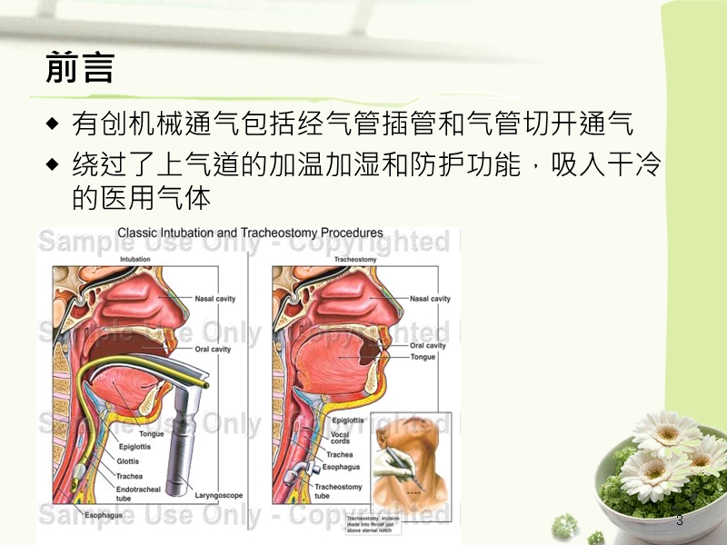 机械通气患者气道湿化方式的应用.pptx_第3页