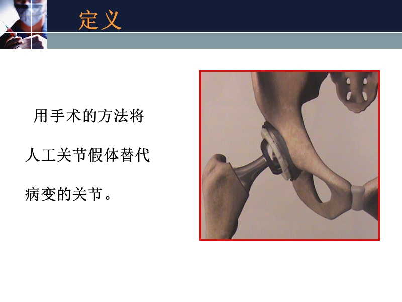 全髋关节置换.ppt_第2页