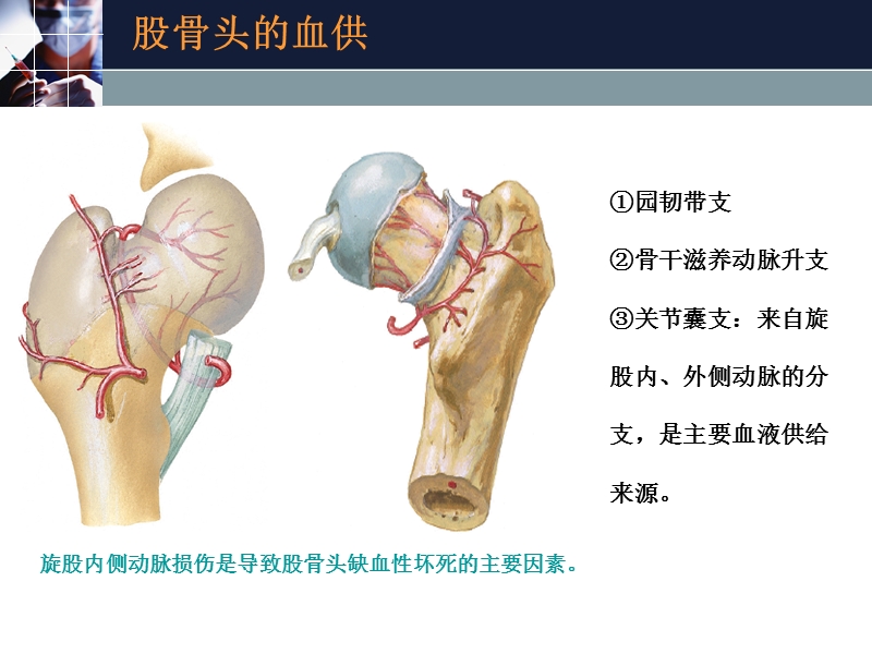 全髋关节置换.ppt_第3页