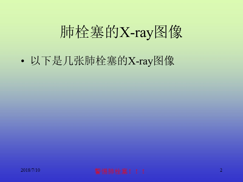 肺动脉栓塞的影像图片.ppt_第2页