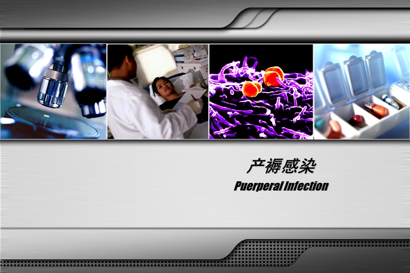 产褥感染.ppt_第1页