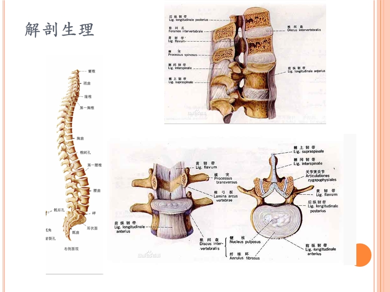 腰椎间盘突出症.pptx_第3页