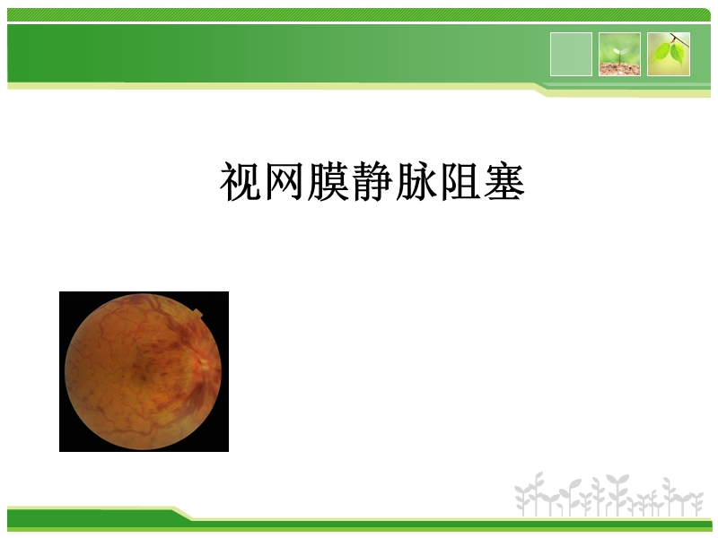 视网膜静脉阻塞.ppt_第1页