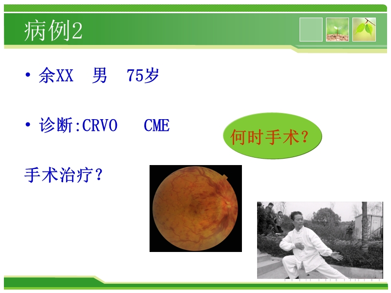 视网膜静脉阻塞.ppt_第3页