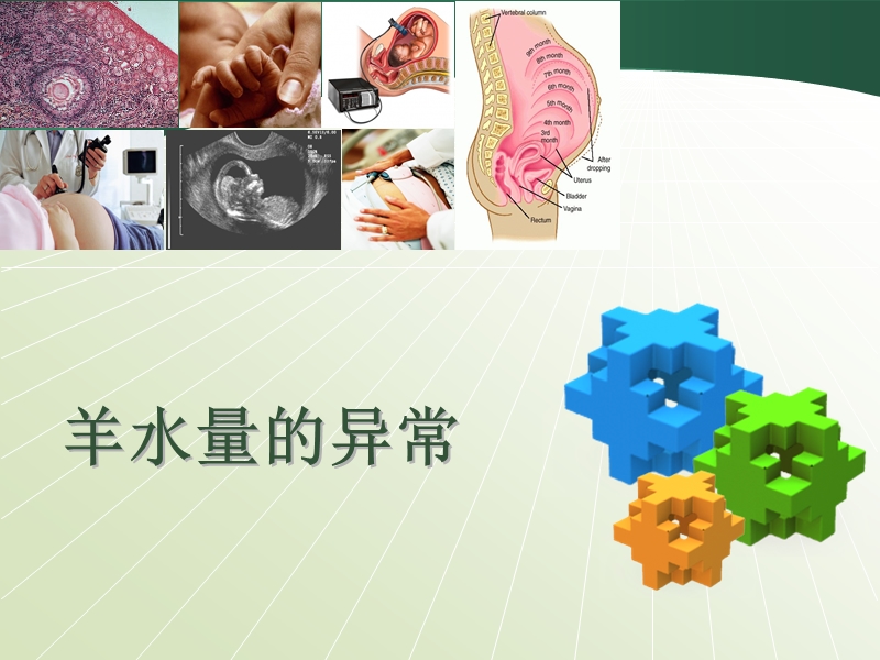 羊水异常.ppt_第1页