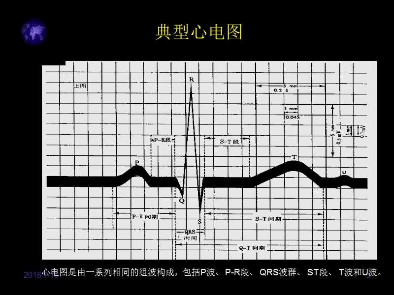 心电图入门精要.ppt_第3页