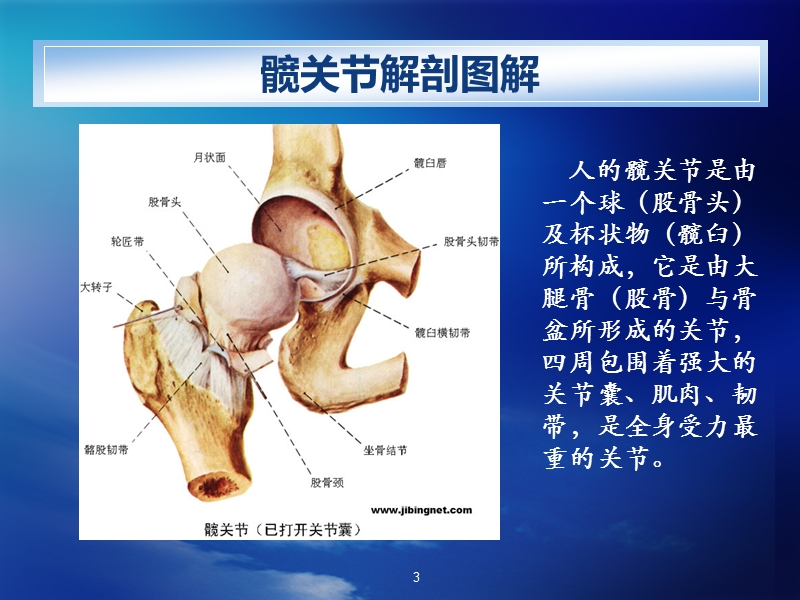 人工髋关节置换术.ppt_第3页