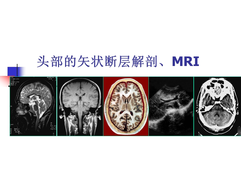 头部的矢状断层解剖应用.ppt_第1页