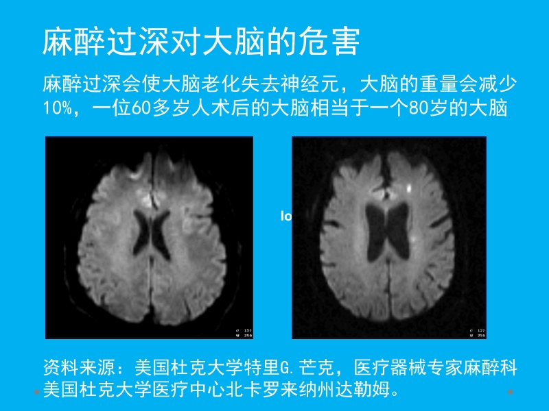 脑电麻醉深度参数与临床运用.pptx_第2页