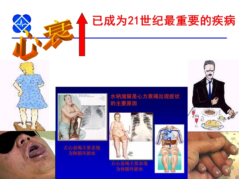 2014中国心衰指南解读.ppt_第2页