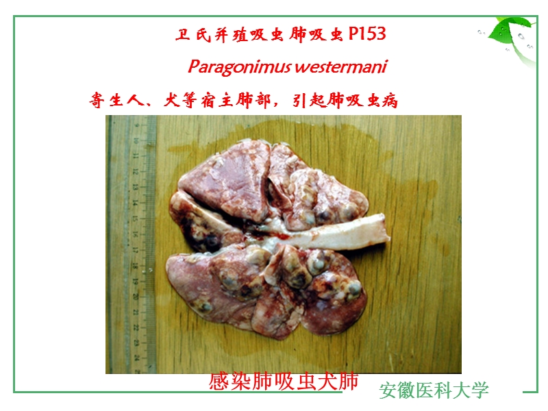 2014-2-20肺吸虫.ppt_第1页