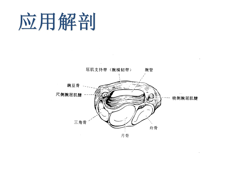 腕管综合症microsoft-office-powerpoint-2007-幻灯片.pptx_第3页