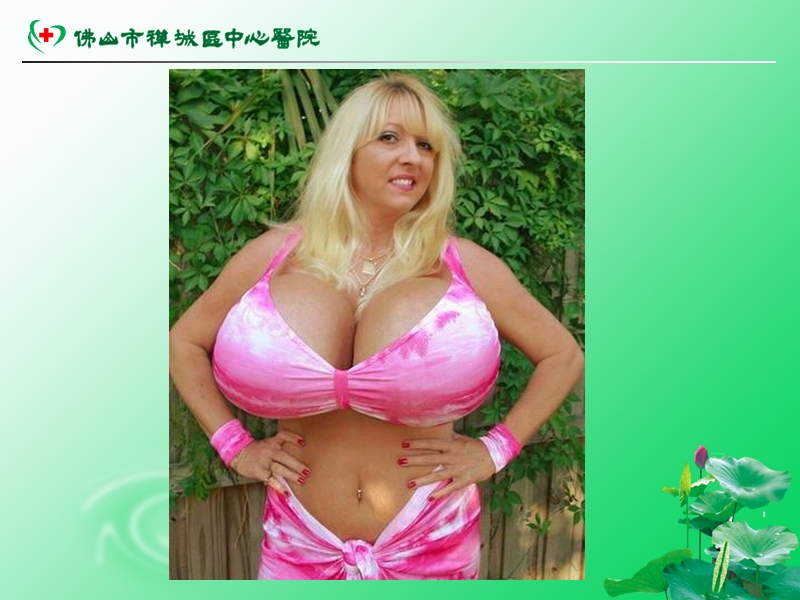 乳腺癌的防治.ppt_第2页