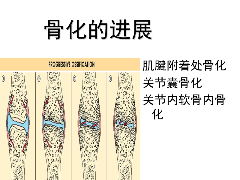 强脊腰突.ppt_第3页