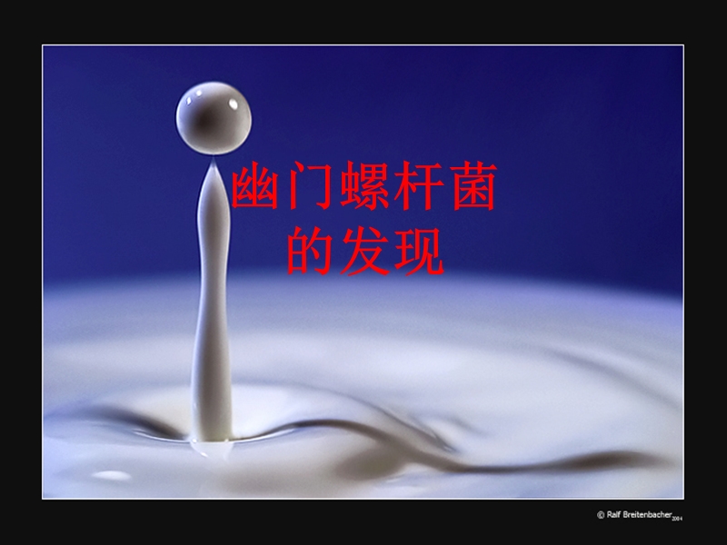 有关幽门螺杆菌的若干问题.ppt_第3页