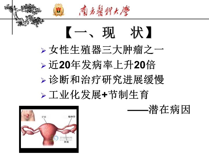 卵巢肿瘤.ppt_第3页