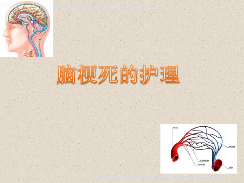 脑梗死的护理.ppt_第1页