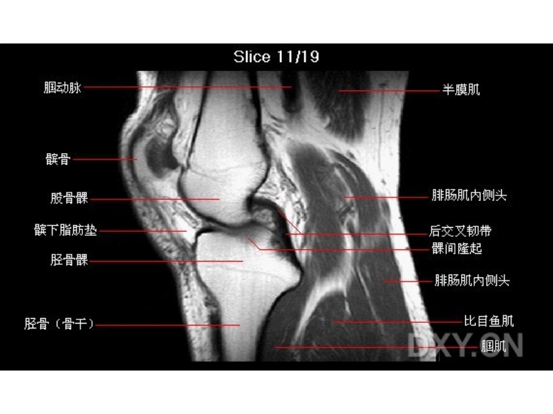 膝部mri解剖.ppt_第1页