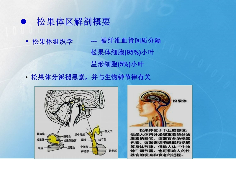 松果体区病变影像学表现.pptx_第3页