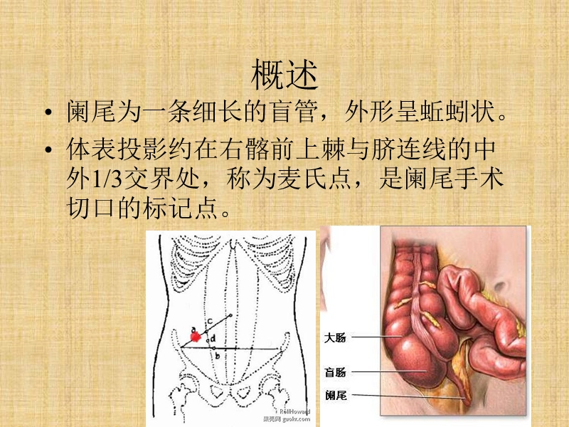 急性阑尾炎及其护理.ppt_第3页