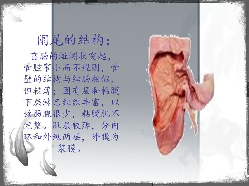 消化系统pbl学习：急性阑尾炎阑尾手术的切口.ppt_第2页