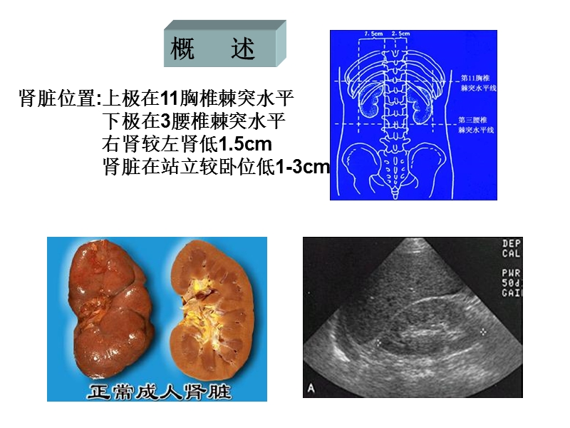 肾脏增大和缩小的诊断及鉴别诊断.ppt_第3页