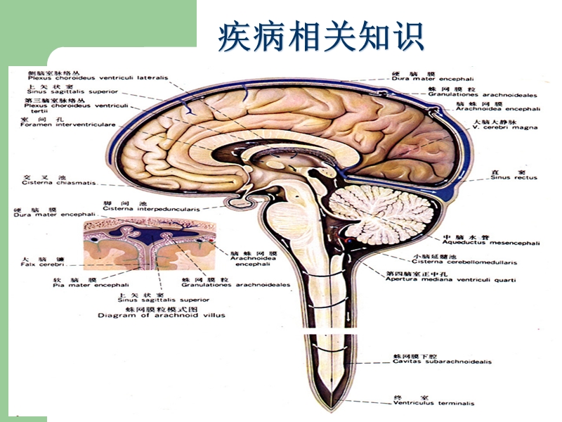 蛛网膜下腔出血护理查房..pptx_第3页