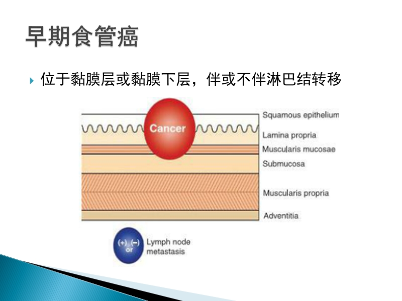 nbi+放大在食管早癌诊断中的应用进展.ppt_第2页