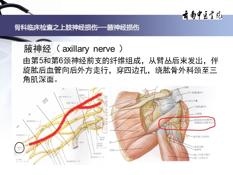 上肢神经损伤之特殊检查.ppt_第2页