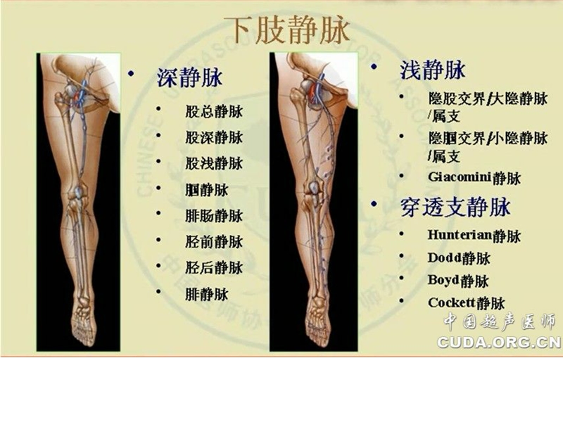 下肢静脉检查.ppt_第1页