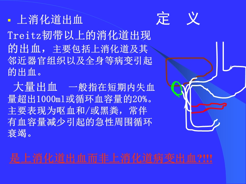 上消化道出血的处理.ppt_第3页