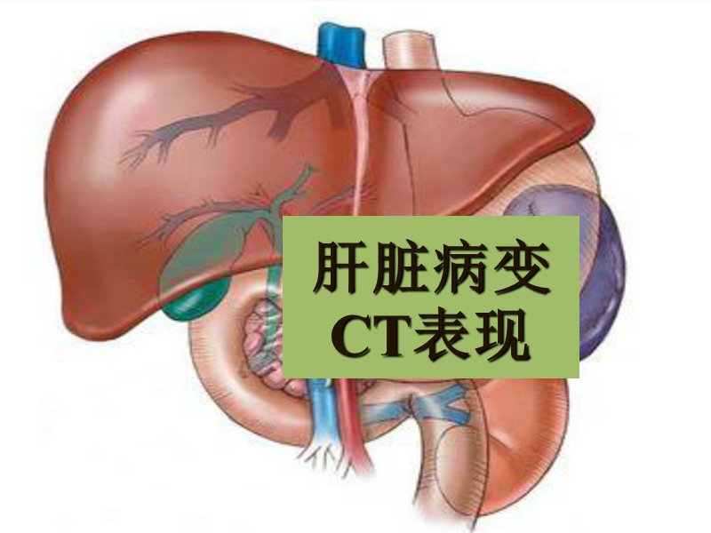 ct肝脏病变.ppt_第1页