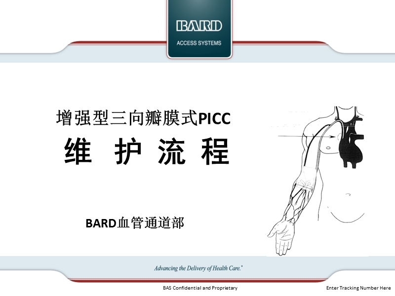 三向瓣膜picc维护流程.pptx_第1页