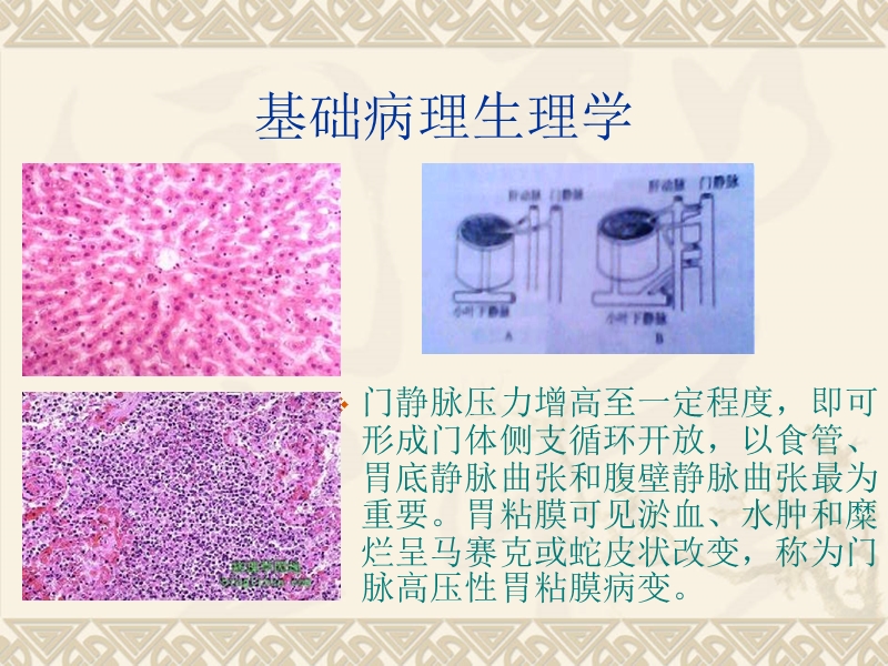 上消血的治疗与护理.ppt_第3页