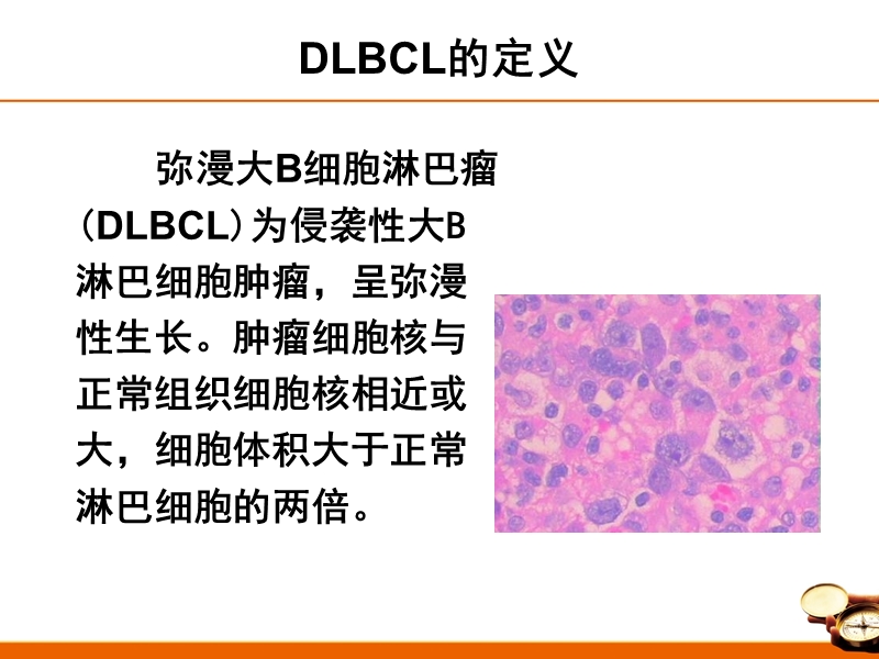 中国弥漫大b细胞淋巴瘤诊治指南2013.ppt_第2页