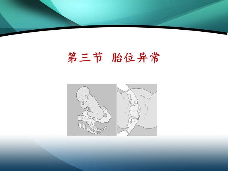 八年制_胎位异常.ppt_第2页