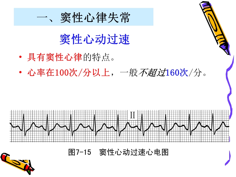 常见心律失常.ppt_第3页