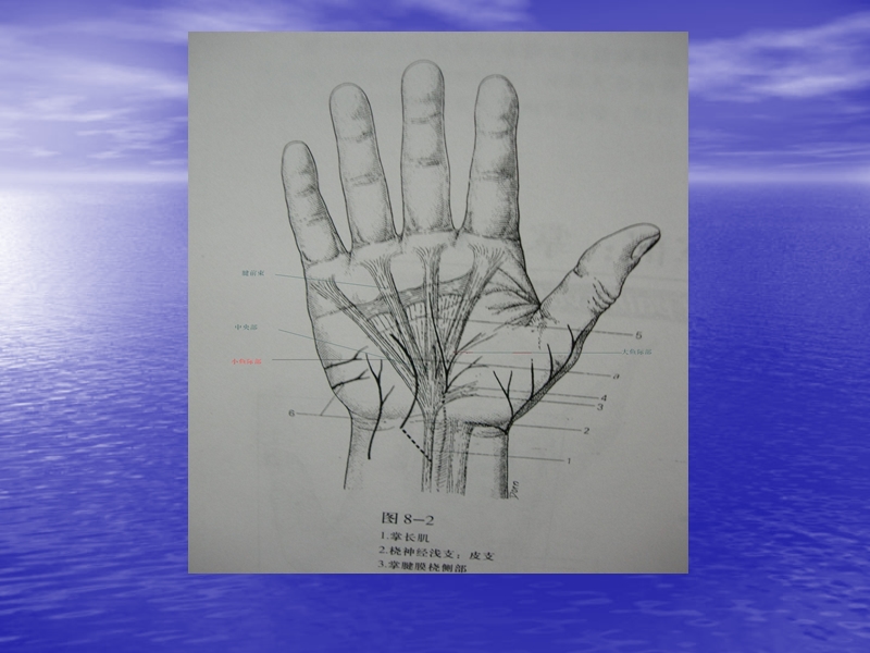 掌腱膜挛缩.ppt_第2页