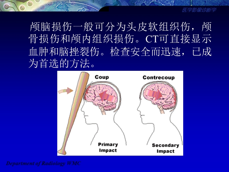 医学影像诊断学颅脑篇.ppt_第2页