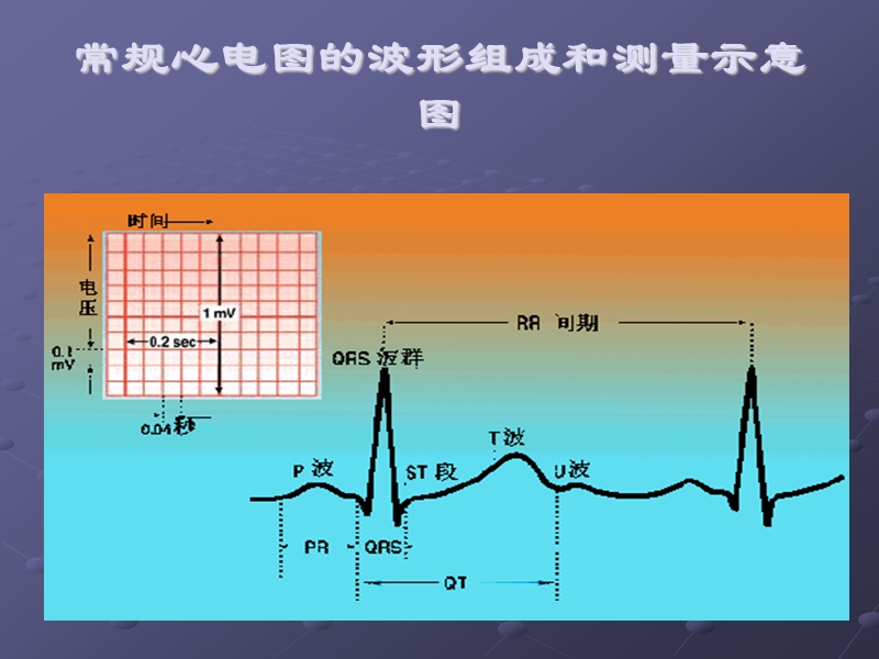 急诊恶性心律失常识别与处理.ppt_第3页