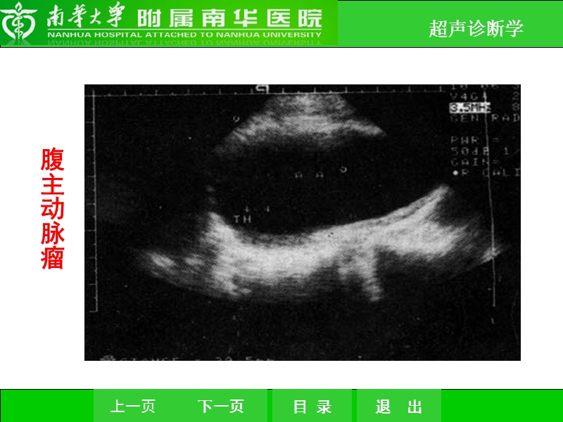 周围血管超声.ppt_第3页