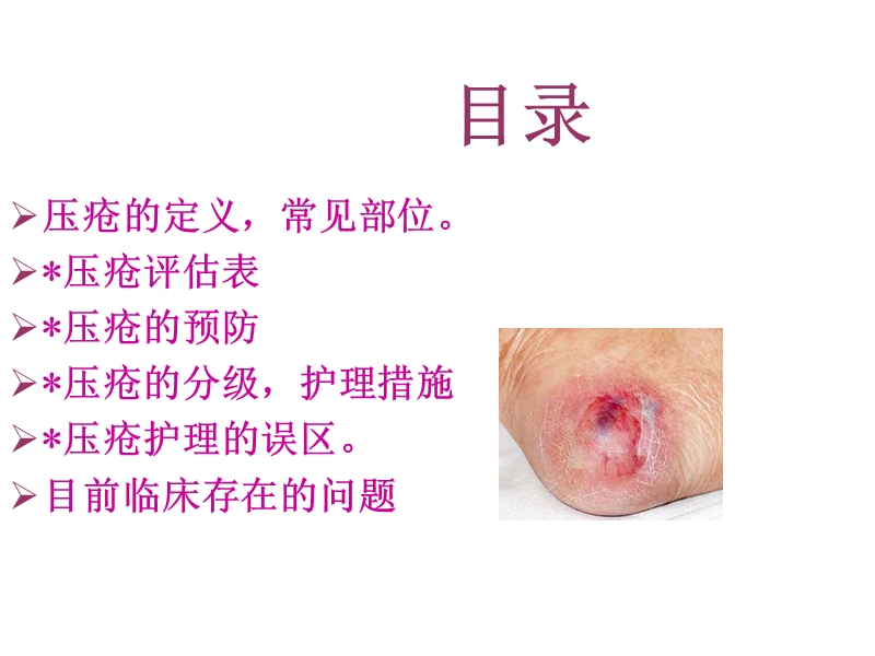 压疮护理.ppt_第2页