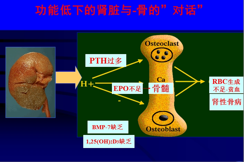 慢性肾脏病骨病.ppt_第2页